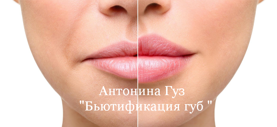[Антонина Гуз] Бьютификация губ (2023)